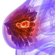 Illustration for article titled New Law Would Require Physicians to Notify Women With Dense Breasts
